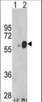 Arylsulfatase B antibody, LS-C156518, Lifespan Biosciences, Western Blot image 