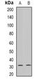 Gap Junction Protein Beta 3 antibody, abx141484, Abbexa, Western Blot image 