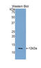 C-X-C Motif Chemokine Ligand 8 antibody, LS-C301185, Lifespan Biosciences, Western Blot image 