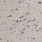 Pyruvate Dehyrogenase Phosphatase Catalytic Subunit 1 antibody, NBP1-87308, Novus Biologicals, Immunohistochemistry paraffin image 