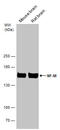 Neurofilament Medium antibody, GTX133215, GeneTex, Western Blot image 