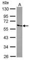 Zinc Finger And SCAN Domain Containing 26 antibody, PA5-30246, Invitrogen Antibodies, Western Blot image 