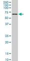 T-Box 18 antibody, H00009096-M06, Novus Biologicals, Western Blot image 