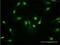 Pyruvate Kinase M1/2 antibody, H00005315-M08, Novus Biologicals, Immunocytochemistry image 
