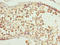 Cilia And Flagella Associated Protein 52 antibody, LS-C399719, Lifespan Biosciences, Immunohistochemistry paraffin image 