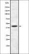 NPHS2 Stomatin Family Member, Podocin antibody, orb337389, Biorbyt, Western Blot image 