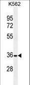Forkhead Box I3 antibody, LS-C166228, Lifespan Biosciences, Western Blot image 
