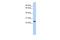 T-cell surface glycoprotein YE1/48 antibody, A30143, Boster Biological Technology, Western Blot image 