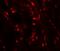 WAP Four-Disulfide Core Domain 2 antibody, GTX17207, GeneTex, Immunohistochemistry paraffin image 