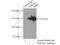 Thyroid Hormone Receptor Associated Protein 3 antibody, 19744-1-AP, Proteintech Group, Immunoprecipitation image 