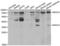 NK2 Homeobox 5 antibody, LS-C334191, Lifespan Biosciences, Western Blot image 