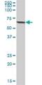 Acyl-CoA Synthetase Medium Chain Family Member 3 antibody, H00006296-B01P, Novus Biologicals, Western Blot image 