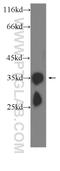 Crystallin Beta B1 antibody, 60273-1-Ig, Proteintech Group, Western Blot image 