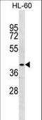 Nuclear Receptor Subfamily 2 Group E Member 1 antibody, LS-C158001, Lifespan Biosciences, Western Blot image 