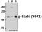 Signal Transducer And Activator Of Transcription 6 antibody, A00523Y641, Boster Biological Technology, Western Blot image 