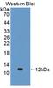 Aggrecan antibody, LS-C292678, Lifespan Biosciences, Western Blot image 