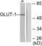 Solute Carrier Family 2 Member 1 antibody, abx013097, Abbexa, Western Blot image 