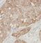 Ras GTPase-activating-like protein IQGAP1 antibody, FNab04378, FineTest, Immunohistochemistry paraffin image 