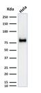 CD44 antibody, GTX34515, GeneTex, Western Blot image 