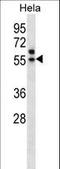 Transcriptional Adaptor 3 antibody, LS-C161683, Lifespan Biosciences, Western Blot image 