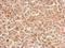 Killer Cell Lectin Like Receptor C1 antibody, LS-C185994, Lifespan Biosciences, Immunohistochemistry paraffin image 