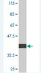 Ubiquitination Factor E4B antibody, H00010277-M02, Novus Biologicals, Western Blot image 