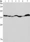 Glutamic-Oxaloacetic Transaminase 2 antibody, TA350033, Origene, Western Blot image 