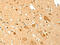 TNF Receptor Associated Factor 6 antibody, CSB-PA954966, Cusabio, Immunohistochemistry paraffin image 