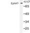 EPH Receptor A7 antibody, LS-C176815, Lifespan Biosciences, Western Blot image 