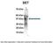 SET Nuclear Proto-Oncogene antibody, PA5-44576, Invitrogen Antibodies, Immunoprecipitation image 
