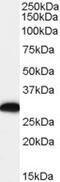 EF-Hand Domain Family Member D2 antibody, TA302973, Origene, Western Blot image 