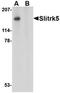 SLIT And NTRK Like Family Member 5 antibody, orb74941, Biorbyt, Western Blot image 