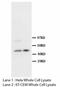 S-Phase Kinase Associated Protein 2 antibody, LS-C171855, Lifespan Biosciences, Western Blot image 