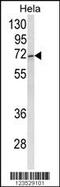 ASPSCR1 Tether For SLC2A4, UBX Domain Containing antibody, 63-658, ProSci, Western Blot image 