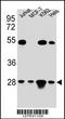 Transcription factor A, mitochondrial antibody, TA324361, Origene, Western Blot image 