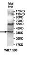 PIN2 (TERF1) Interacting Telomerase Inhibitor 1 antibody, orb78128, Biorbyt, Western Blot image 