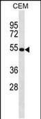 Netrin 3 antibody, PA5-48722, Invitrogen Antibodies, Western Blot image 