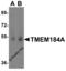 Transmembrane Protein 184A antibody, 5681, ProSci Inc, Western Blot image 