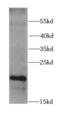 Retinoic Acid Receptor Responder 2 antibody, FNab07123, FineTest, Western Blot image 