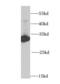 Hydroxyacyl-CoA Dehydrogenase antibody, FNab03747, FineTest, Western Blot image 