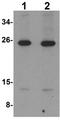 LIF Interleukin 6 Family Cytokine antibody, ab113262, Abcam, Western Blot image 