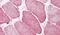 Semaphorin 4B antibody, PA5-34192, Invitrogen Antibodies, Immunohistochemistry paraffin image 
