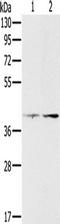Platelet Derived Growth Factor Receptor Like antibody, TA350271, Origene, Western Blot image 