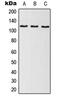 Elongation Factor Tu GTP Binding Domain Containing 2 antibody, LS-C353155, Lifespan Biosciences, Western Blot image 