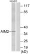 Interferon-inducible protein AIM2 antibody, abx013903, Abbexa, Western Blot image 