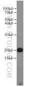 Translocase Of Inner Mitochondrial Membrane 22 antibody, 14927-1-AP, Proteintech Group, Western Blot image 