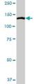 Myosin Light Chain Kinase antibody, H00004638-D01P, Novus Biologicals, Western Blot image 