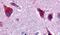 Ceramide Kinase antibody, PA5-32706, Invitrogen Antibodies, Immunohistochemistry frozen image 