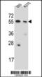 Copine 8 antibody, 61-887, ProSci, Western Blot image 
