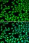 Rhotekin antibody, LS-C748402, Lifespan Biosciences, Immunofluorescence image 